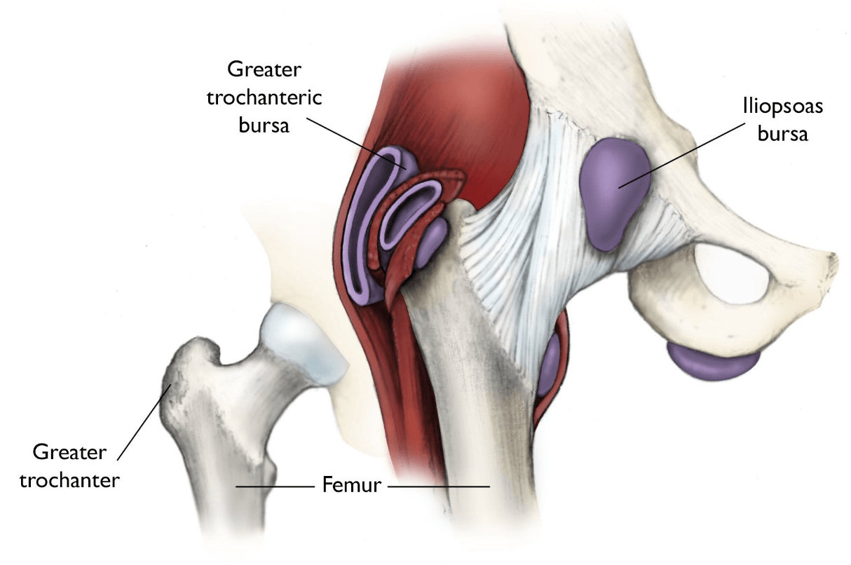 Hip Bursitis